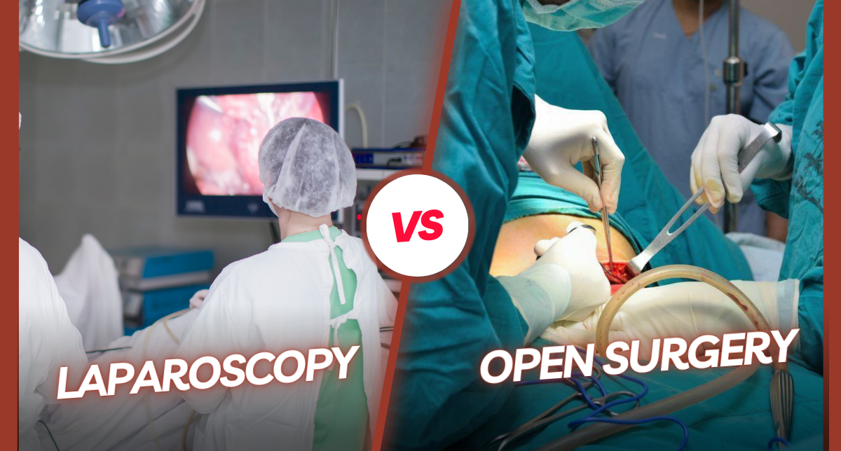 laparoscopy vs open surgery